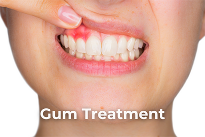 CQD Gum Treatment